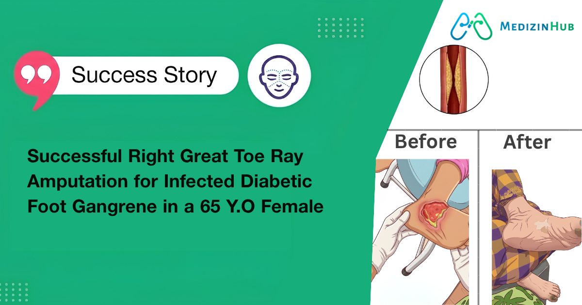 Real Patient Story: Mala’s Diabetic Foot Transformation