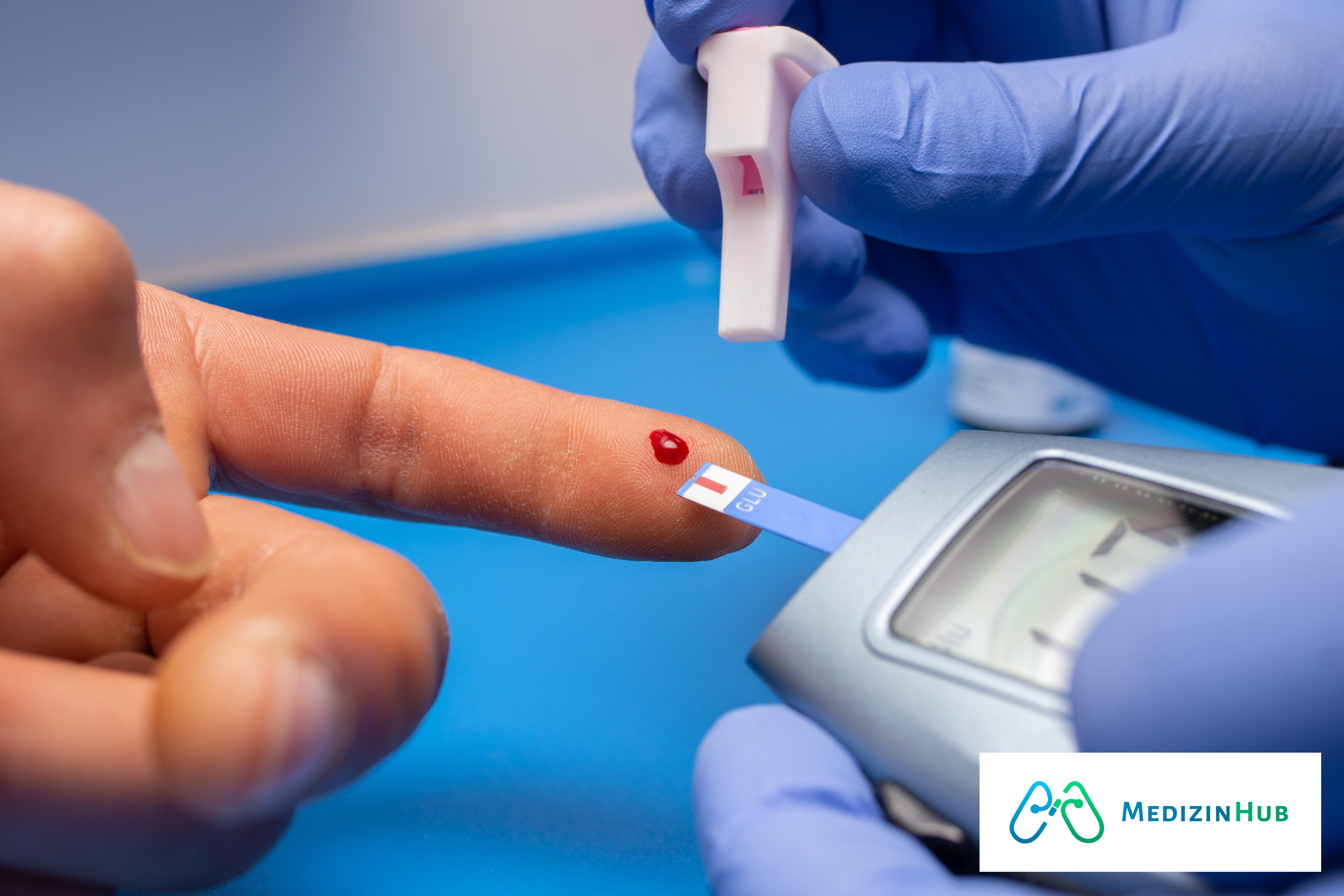 Sugar Test: A Simple Way to Check Your Blood Sugar Levels.